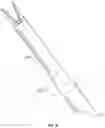 Fig. 06 - SOFT AND HARD TISSUE EXCISIONAL DEVICES AND METHODS