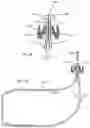 Fig. 09 - Systems, devices, and methods for closing an abdominal wall defect