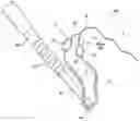 Fig. 01 - Surgical constructs with shuttling loops and methods of tissue fixation