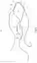 Fig. 04 - Surgical constructs with shuttling loops and methods of tissue fixation