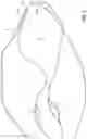 Fig. 05 - Surgical constructs with shuttling loops and methods of tissue fixation