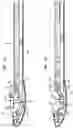 Fig. 06 - Suture system