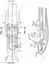 Fig. 19 - Suture system