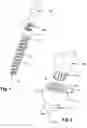 Fig. 02 - Screw element for use in spinal, orthopedic or trauma surgery and a system of such a screw element and a screw driver adapted thereto