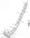 Fig. 09 - Bone stabilization systems