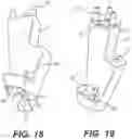 Fig. 20 - Bone stabilization systems