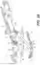 Fig. 21 - Bone stabilization systems