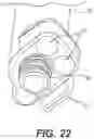 Fig. 23 - Bone stabilization systems