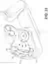 Fig. 24 - Bone stabilization systems