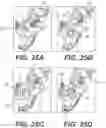 Fig. 26 - Bone stabilization systems