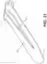 Fig. 30 - Bone stabilization systems