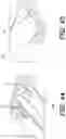 Fig. 40 - Bone stabilization systems