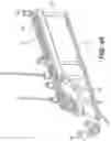 Fig. 41 - Bone stabilization systems