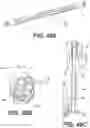Fig. 43 - Bone stabilization systems