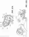 Fig. 46 - Bone stabilization systems