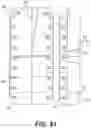 Fig. 55 - Bone stabilization systems