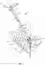 Fig. 02 - Surgical instrument and method