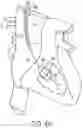 Fig. 06 - Method and system for transcatheter intervention
