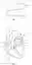 Fig. 02 - CARDIAC IMPLANT DELIVERY SYSTEM