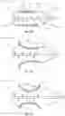 Fig. 07 - CARDIAC IMPLANT DELIVERY SYSTEM