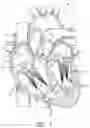 Fig. 02 - REVERSE VENTRICULAR REMODELING AND PAPILLARY MUSCLE APPROXIMATION