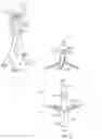 Fig. 02 - Method and apparatus for fixating endovascular prostheses