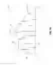 Fig. 11 - Spinal Specific Postural Correction Devices