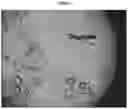 Fig. 05 - IMMEDIATE RELEASE PHARMACEUTICAL FORMULATION OF 4-[3-(4-CYCLOPROPANECARBONYL-PIPERAZINE-1-CARBONYL)-4-FLUORO-BENZYL]-2H-PHTHALAZIN-1-ONE