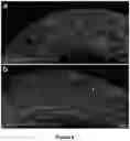 Fig. 07 - CARDIAC PROGENITOR CELLS HAVING ENHANCED p53 EXPRESSION AND USES THEREOF