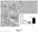 Fig. 07 - Method for preventing and treating tissue and organ fibrosis