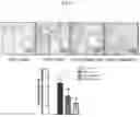 Fig. 02 - COMPOSITIONS AND METHODS FOR TREATING OR AMELIORATING FIBROSIS, SYSTEMIC SCLEROSIS, SCLERODERMA AND GRAFT VERSUS HOST DISEASE
