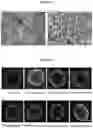 Fig. 02 - Method for the Treatment of a Solid Tumour