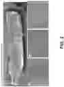 Fig. 04 - Drug eluting stent and method of use of the same for enabling restoration of functional endothelial cell layers
