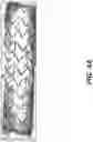 Fig. 06 - Drug eluting stent and method of use of the same for enabling restoration of functional endothelial cell layers