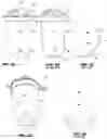 Fig. 03 - Fluid waste canister