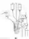 Fig. 02 - Heart pump providing adjustable outflow