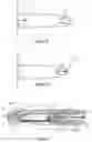 Fig. 04 - DEVICES AND METHODS FOR DELIVERING PARTICLES