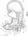 Fig. 03 - Machine proximate nebulizer