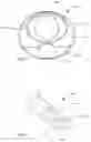 Fig. 03 - Systems and methods for measuring and controlling pressure within an internal body cavity