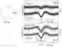 Fig. 08 - System for bilateral in-ear EEG recording with closed-loop binaural sensory stimulation