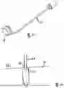 Fig. 06 - Cannula having a wire that extends along said cannula