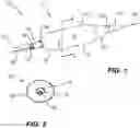 Fig. 02 - Catheter with markings to facilitate alignment