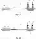 Fig. 07 - Dilation device and method of use