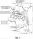 Fig. 02 - Medical systems, devices, and related methods