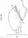 Fig. 02 - Devices and methods for cosmetic skin resurfacing