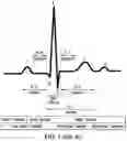 Fig. 02 - Systems, methods, and devices for treating bradyarrhythmias, tachyarrhythmias and heart failure