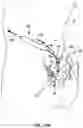 Fig. 13 - Cannula configured to deliver test stimulation