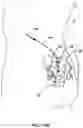 Fig. 15 - Cannula configured to deliver test stimulation