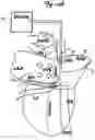 Fig. 02 - Method and device for atrial cardioversion therapy