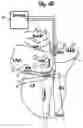 Fig. 03 - Method and device for atrial cardioversion therapy